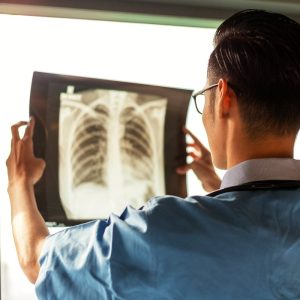 compensation-for-fractured-ribs-resulting-from-a-st-louis-car-crash